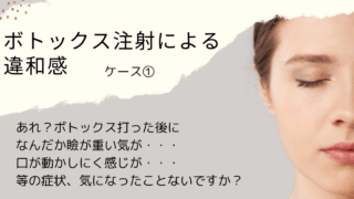 ボトックス注射による違和感①