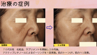 治療症例紹介