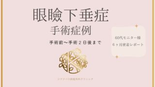 眼瞼下垂症手術症例 手術後~手術2日