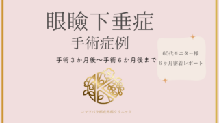 眼瞼下垂症手術症例 手術3か月後~手術6か月後