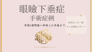 眼瞼下垂症手術症例 手術2週間後~手術2か月後